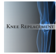 Knee Replacement